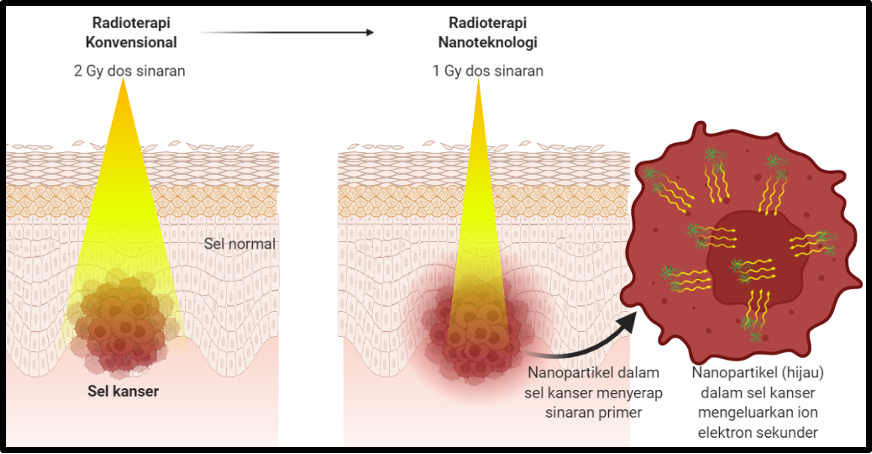nanoteknologi