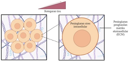 ketegaran tisu pembentukan kanser